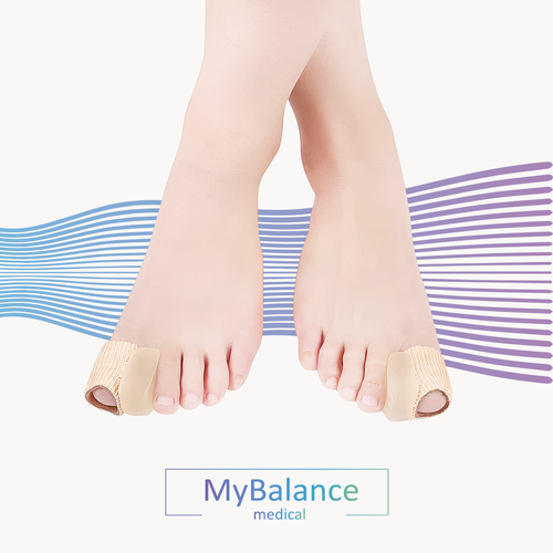     MyBalance,    , ,  M 315